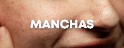 Manchas Skincare coreano